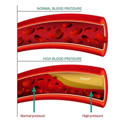  Blood Pressure Regulation