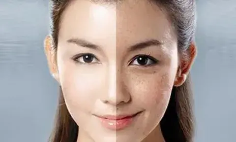 Alpha Arbutin Powder for Skin Alpha Arbutin Powder for Skin