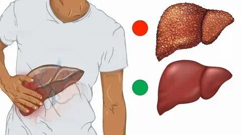 Liver Health